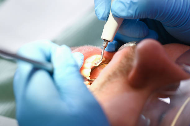 Best Emergency Denture Repair in Kansas City, KS